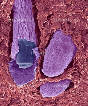 毛穴 走査型電子顕微鏡 の画像素材 科学 テクノロジーの写真素材ならイメージナビ