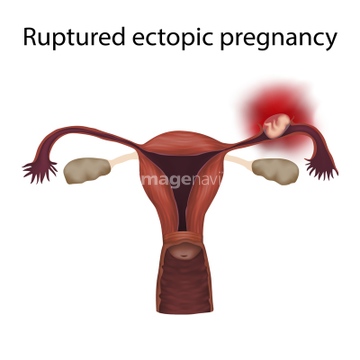 女性器 子供 卵管 の画像素材 ライフスタイル イラスト Cgの写真素材ならイメージナビ