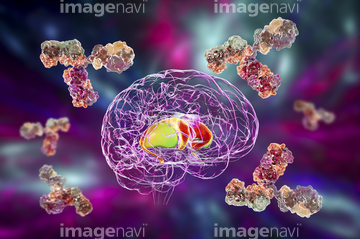 大脳基底核 苦しみ の画像素材 医療 イラスト Cgの写真素材ならイメージナビ