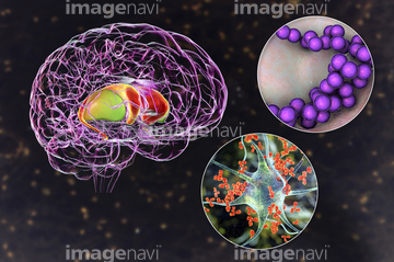 大脳基底核 苦しみ の画像素材 医療 イラスト Cgの写真素材ならイメージナビ