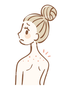 ニキビ イラスト かわいい の画像素材 ライフスタイル イラスト Cgのイラスト素材ならイメージナビ