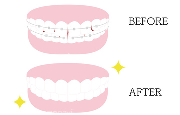 口 歯茎 綺麗 イラスト の画像素材 ライフスタイル イラスト Cgのイラスト素材ならイメージナビ