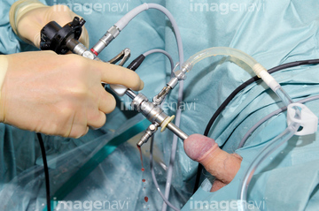 鍵穴手術 男性器 の画像素材 医療 福祉の写真素材ならイメージナビ