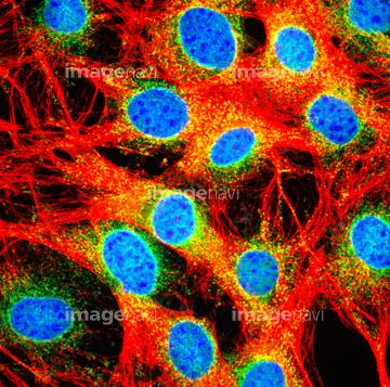 免疫蛍光抗体法 の画像素材 科学 テクノロジーの写真素材ならイメージナビ