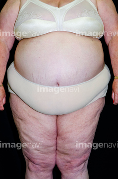 女性 肥満 お腹 60代 の画像素材 写真素材ならイメージナビ