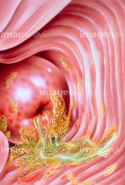 子宮 膣 医療 の画像素材 医療 イラスト Cgの写真素材ならイメージナビ