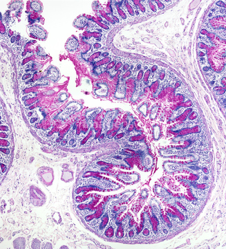 リーベルキューン腺小窩 の画像素材 科学 テクノロジーの写真素材ならイメージナビ