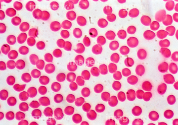 赤血球 光学顕微鏡 の画像素材 科学 テクノロジーの写真素材ならイメージナビ