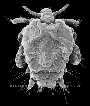 陰毛 の画像素材 体のパーツ 人物の写真素材ならイメージナビ