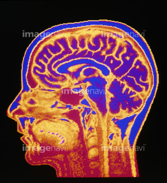 頭部 断面図 の画像素材 科学 テクノロジーの写真素材ならイメージナビ