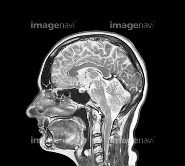 頭部 断面図 の画像素材 科学 テクノロジーの写真素材ならイメージナビ