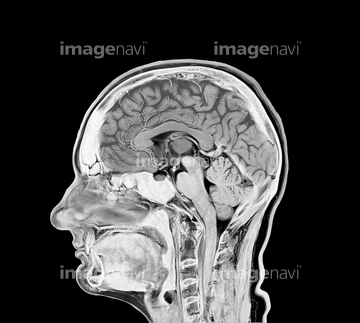 頭部 断面図 の画像素材 科学 テクノロジーの写真素材ならイメージナビ