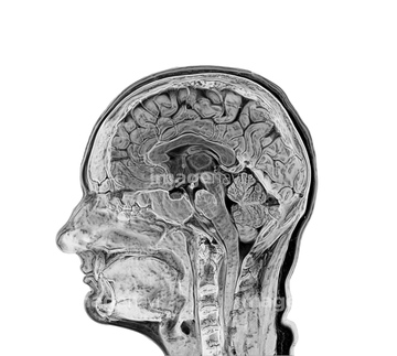 頭部 断面図 の画像素材 科学 テクノロジーの写真素材ならイメージナビ