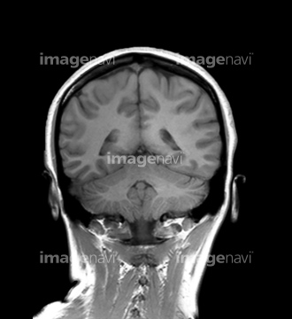 頭部 断面図 の画像素材 科学 テクノロジーの写真素材ならイメージナビ