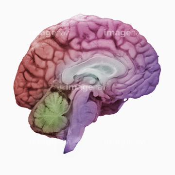 脳梁 の画像素材 医療 イラスト Cgの写真素材ならイメージナビ