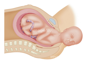 女性器 出産 面 形状 かわいい の画像素材 赤ちゃん 育児 ライフスタイルの写真素材ならイメージナビ
