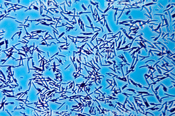 酢酸菌 の画像素材 イラスト Cgの写真素材ならイメージナビ