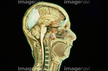 頭部 断面図 の画像素材 科学 テクノロジーの写真素材ならイメージナビ