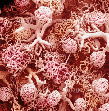 糸球体 走査型電子顕微鏡 の画像素材 病気 体調管理 人物の写真素材ならイメージナビ